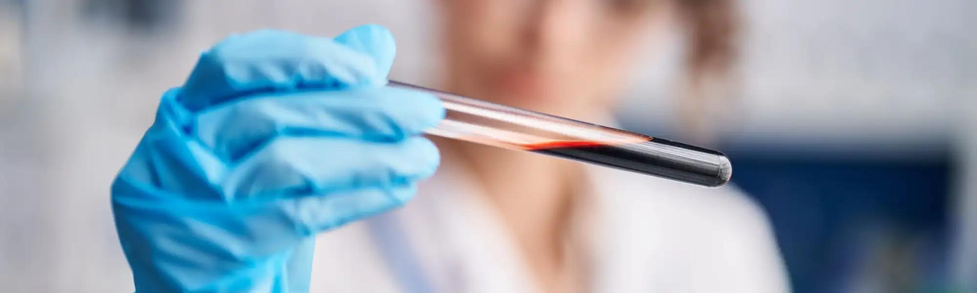 Przeciwciała IgG w organizmie. Jakie informacje dają Pacjentowi? Przeciwciała IgG w organizmie. Jakie informacje dają Pacjentowi?